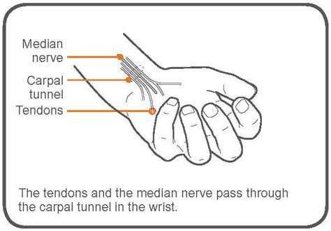 Printable Carpal Tunnel Exercises