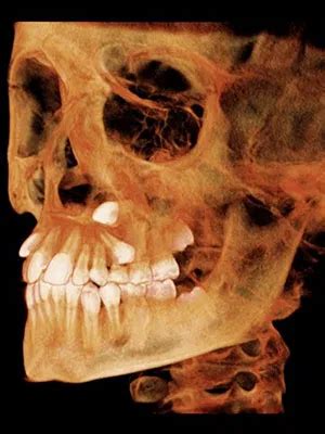 I CAT FLX 3D Imaging Sordelli Orthodontics And Periodontics