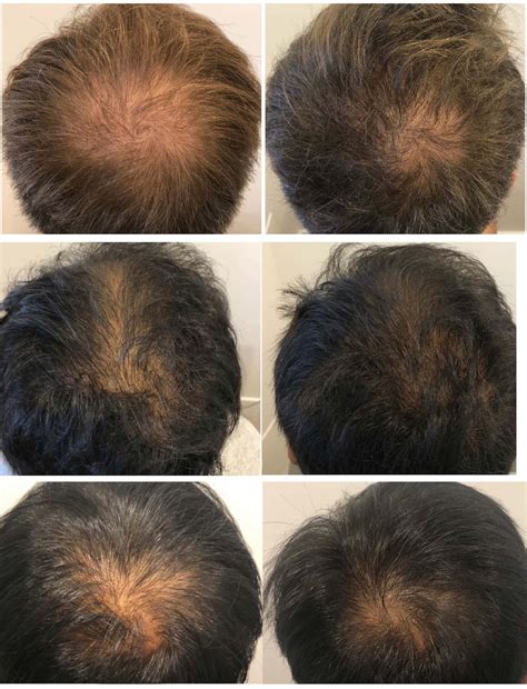Before & Afters - Hair & Skin Science