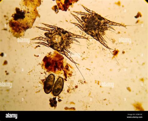 ear mite from a cat, under the microscope Stock Photo - Alamy