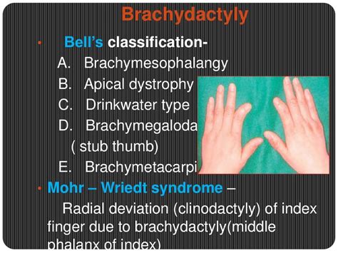 Congenital Hand Anomalies