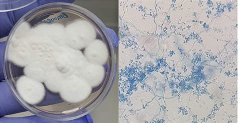 Beauveria sp. : Fredy Alejandro Ortiz : Free Download, Borrow, and ...