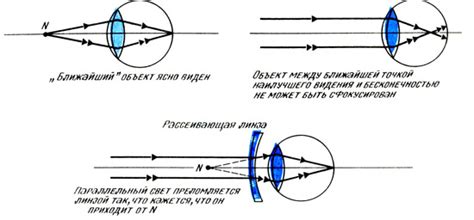 Рассеивающая линза. Близорукость