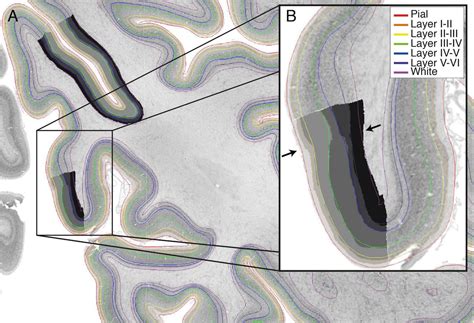 Cerebral Cortex Histology Layers