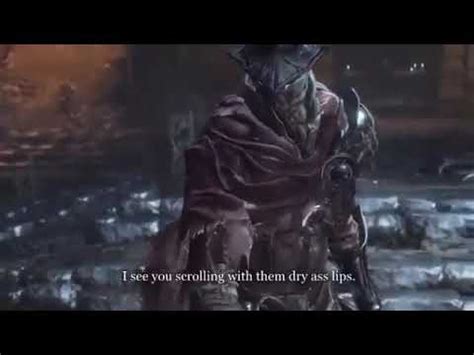 Dry Lips Having Ass Youtube