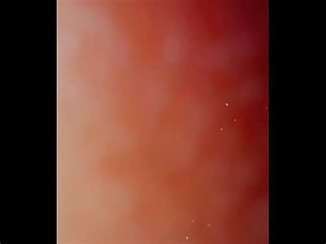 Leggings Tease XVIDEOS