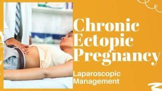 Laparoscopic Management Of Ruptured Ectopic Pregnancy Free