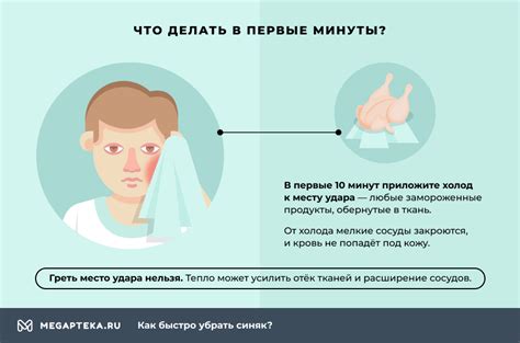 Как убрать синяки под глазами, поможет ли мазь от ушибов