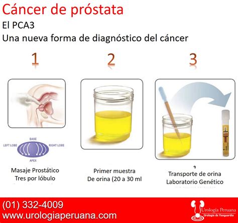 Urología Peruana: Dr. Susaníbar: Una nueva manera de estudiar el cáncer ...