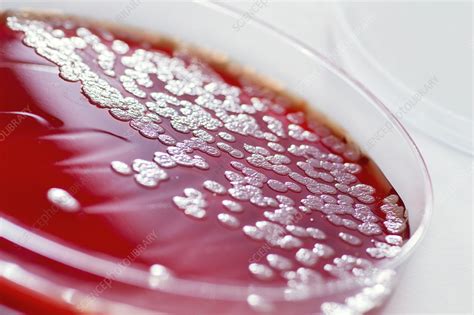Pseudomonas aeruginosa bacterial culture - Stock Image - C036/0547 ...