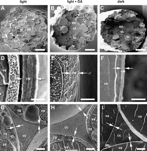 Scanning Electron Micrographs Of Freeze Fracture Surfaces In Hypocotyls