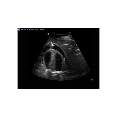 Fast Exam Ultrasound Training Model Transthoracic And Transesophageal