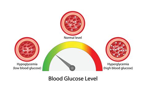how to tell if blood sugar is high 5