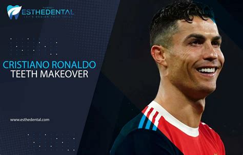 Cristiano Ronaldo Teeth Esthedental
