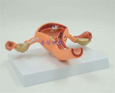The Pathological Model Of The Uterusuterine Anatomygenital Organ