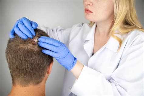 Jak správně aplikovat minoxidil sprej?