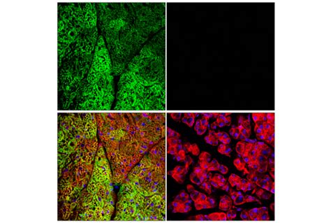 Ucp1 E9z2v Xp® Rabbit Mab Alexa Fluor® 488 Conjugate Cell