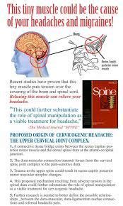 Cervicogenic Headache Icd 10 - Headache