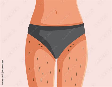 Vecteur Stock Hairy Female Torso Body Positive Vector Concept Illustration Woman Wearing Bikini