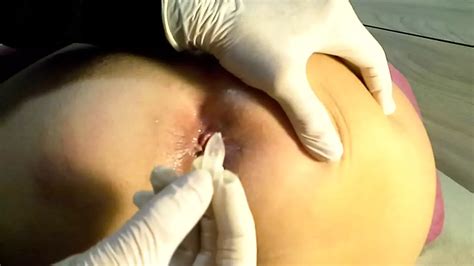 Close Up Anal Inspection Of My Ass Italian Porn XHamster