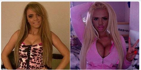 Silicone Lips And Tits Are Essential Scrolller