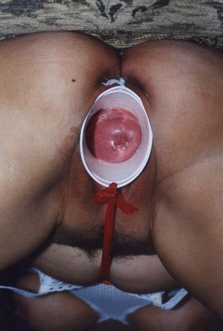 Analsex Open Hole Analsex Open Hole Porn Pic