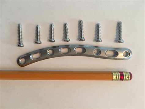 Clavicle INJURY & SURGICAL REPAIR PART 4: COLLARBONE PLATE REMOVAL Q&A