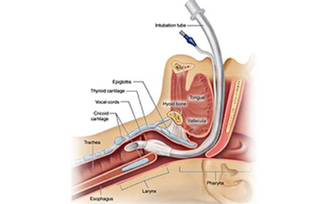 EGENT Center for Ear, Nose & Throat - Services- Vocal cord surgery