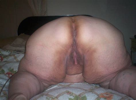 Naked Ass Women Cancer 81 Photos Porn Ddeva