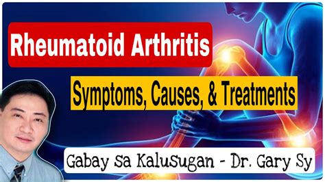 Understanding Rheumatoid Arthritis Dr Gary Sy Youtube