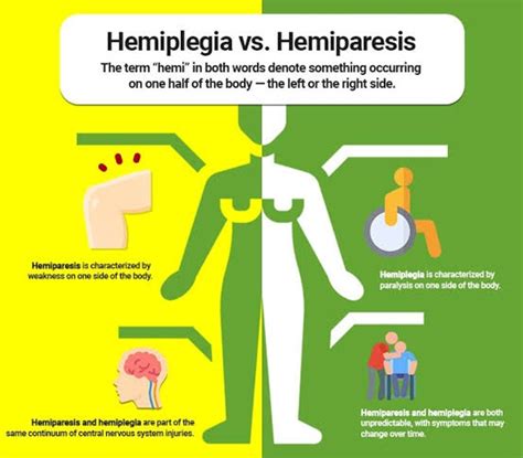 What Is Monoplegia And How Does It Affect Your Body Swasthsankalp