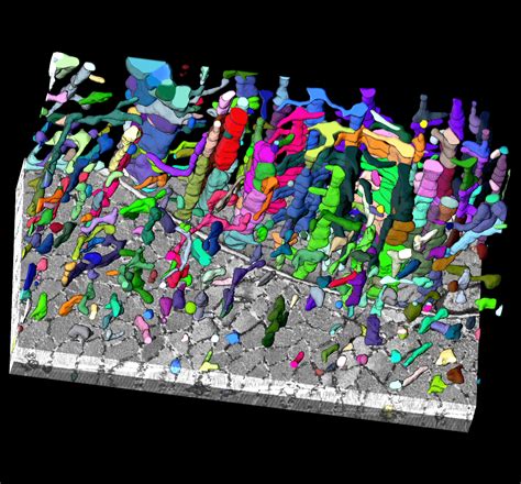 3d Volume Electron Microscopy Explores Mitochondrial And Muscle