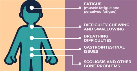 Spinal Muscular Atrophy Sma Symptoms Sma News Today