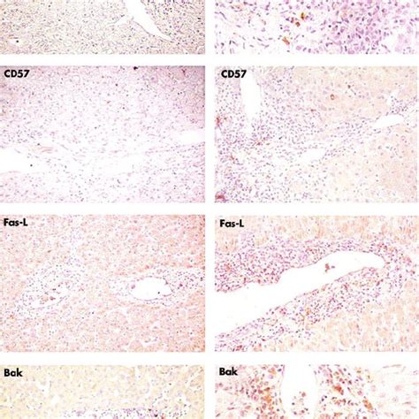 Upper Panel Representative Immunohistochemical Staining For Cd45 Cd3 Download Scientific