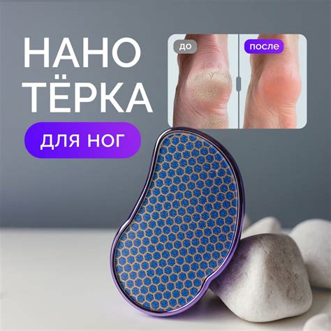 Терка для пяток / Нано пилка для пяток / Пемза для ног - купить с ...
