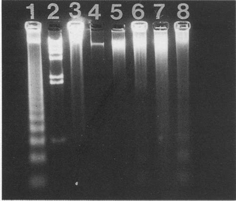 Electrophoresis Dna Ladder