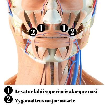 How To Get Rid of Gummy Smile with Botox Injections