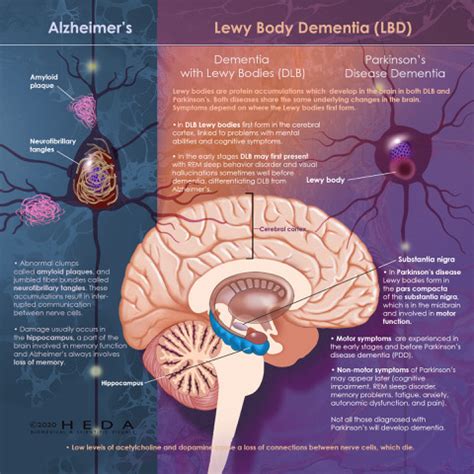 NEW Work Showcase Jackie Heda Artists Blogs Medical Illustration