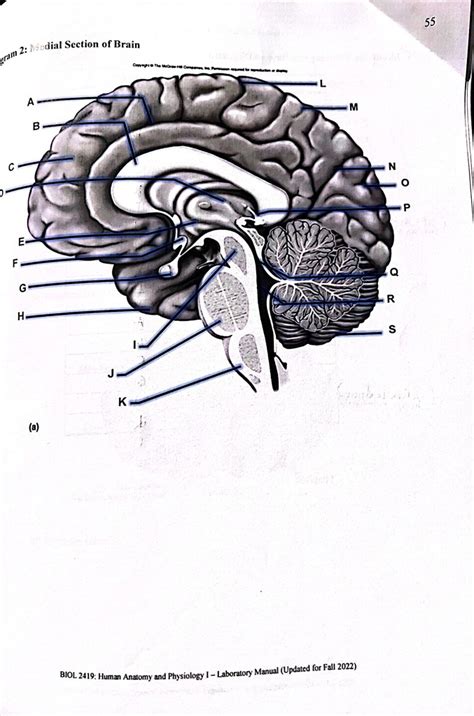 Brain Medial Section 2 Diagram Quizlet