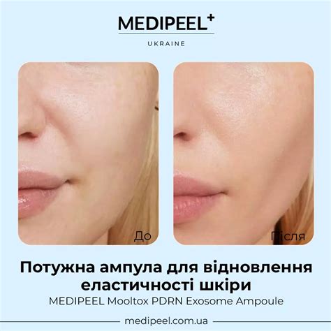 Ампула для регенерации кожи MEDIPEEL Mooltox PDRN Exosome Ampoule ...