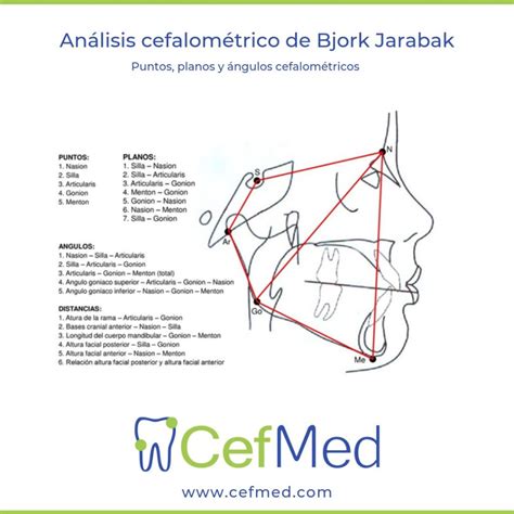 Analisis Cefalom Trico De Bjork Jarabak Cefmed