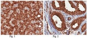 Anti Hepacam Antibody From Rabbit Purified By Affinity