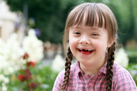 Perbedaan Autis Dan Down Syndrome Yang Perlu Diketahui