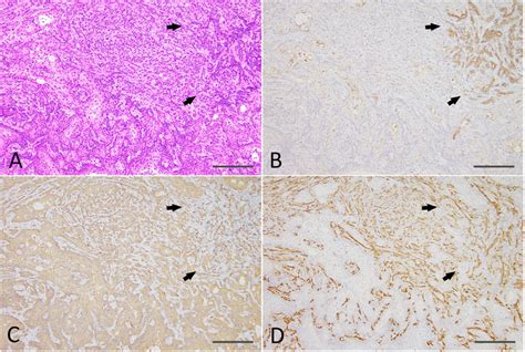 Frontiers The Unique Genetic And Histological Characteristics Of Dmba