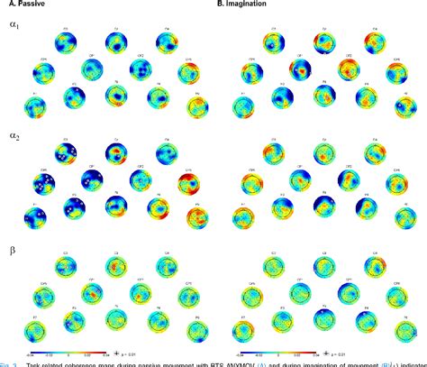 Figure 3 From Quantitative Eeg Evaluation During Robot Assisted Foot