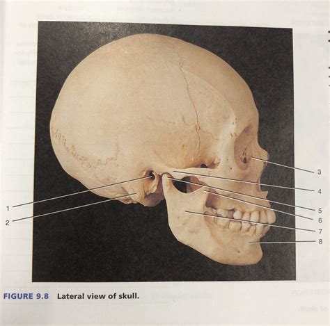 Lateral View Of Skull Bone Markings Diagram Quizlet