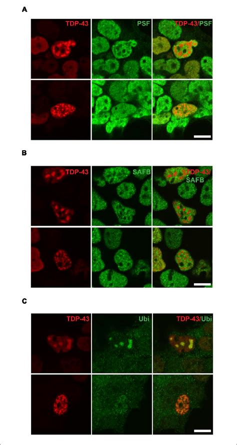 Tar Dna Binding Protein 43 Positive Nuclear Puncta Are Inclusions Of