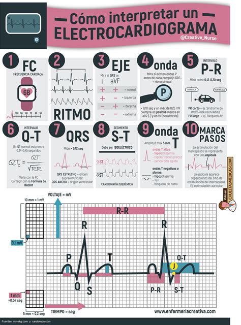 10 Sencillos Pasos Para Interpretar Un Electrocardiograma Chuletas