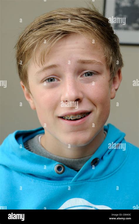 Close Up Of A 13 Year Old Boy Wearing Braces Stock Photo Alamy