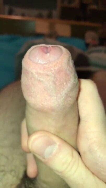 Smegma Days Unwashed Gay Porn Xxx Porn C XHamster XHamster